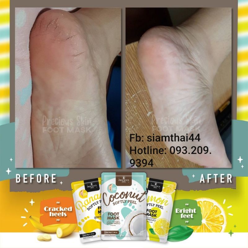 (Lẻ 1 Gói) Mặt Nạ Chân SOFTLY PEEL FOOT MASK BY PRECIOUS SKIN | BigBuy360 - bigbuy360.vn