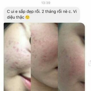 Tái tạo da tether life toner organic