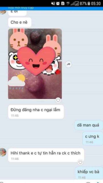 Kem làm  hồng môi nhũ hoa vùng kín | BigBuy360 - bigbuy360.vn