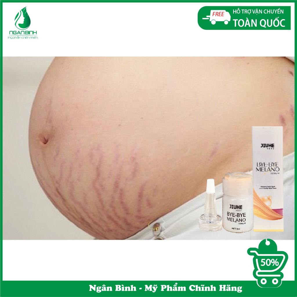 Serum thâm jiuhe, thâm mụn cho da dầu,tinh chất  thâm nám ,thâm môi,thâm mắt,thâm vùng kín,