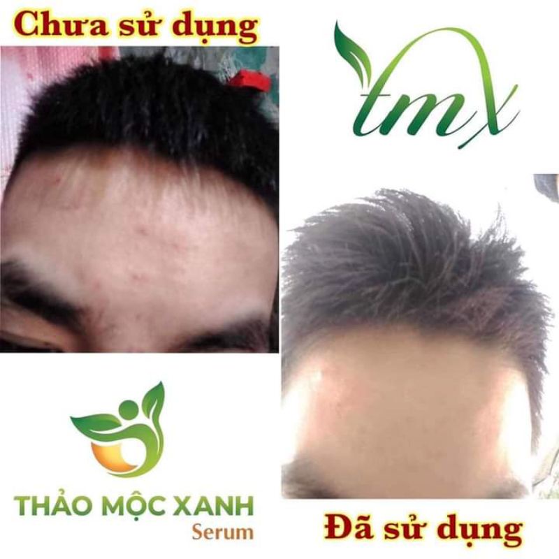 Serum thảo mộc xanh
