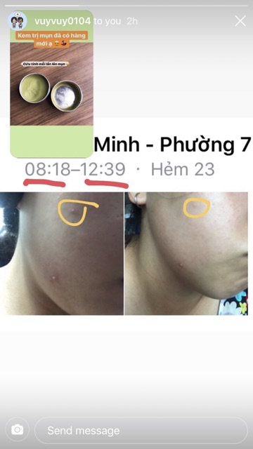  Kem mụn handmade Sunday Beauty | BigBuy360 - bigbuy360.vn