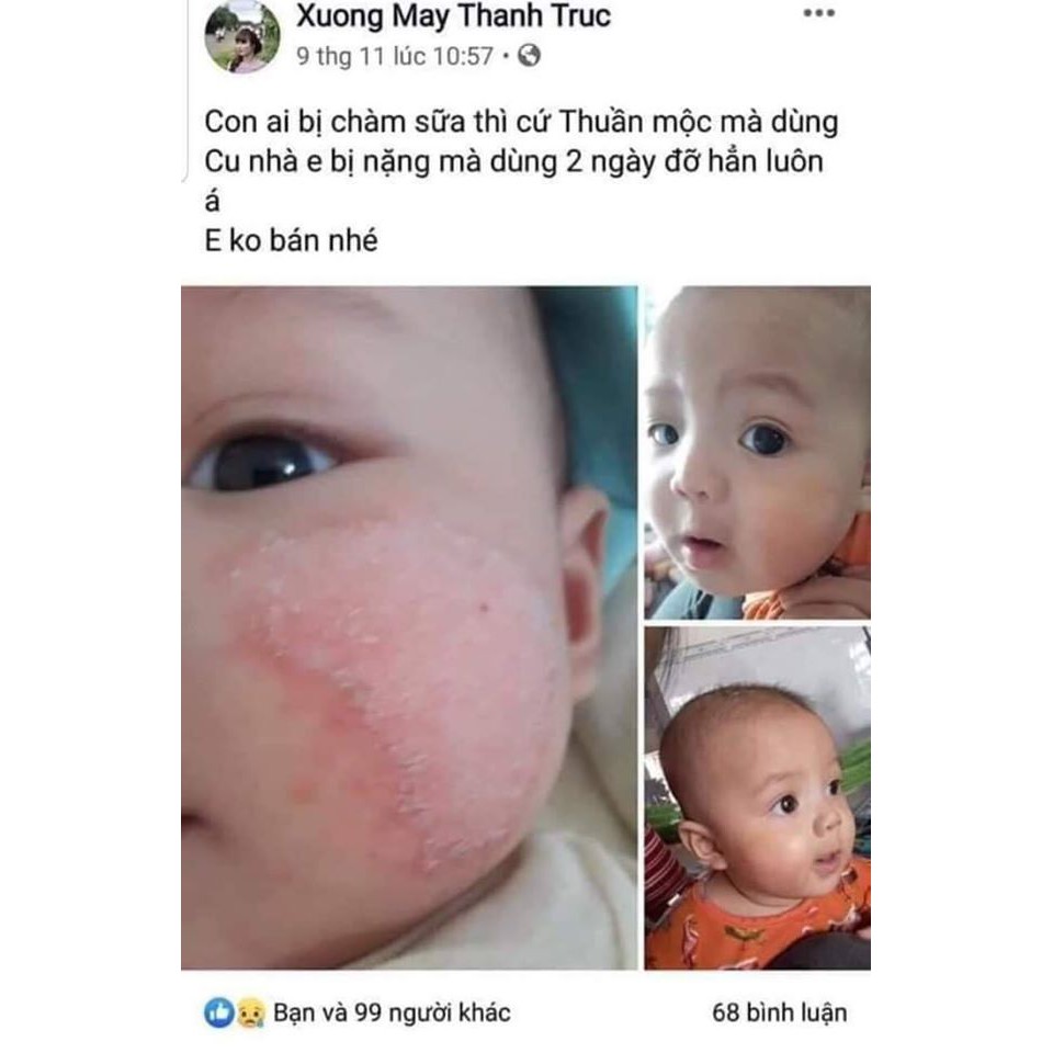 Thuo.c Tri Nấm Ngứa, Nấm Móng, Nấm Da Đầu, Vảy Nến, Á Sừng, Tổ Đỉa, Kem Tri Viem Da, Viem Da Cơ Địa, Ghẻ Lở