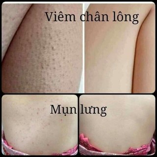 Bột tắm Linhcen