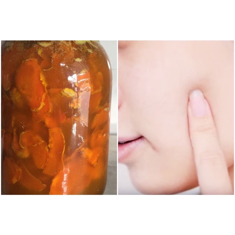 1KG NGHỆ VÀNG TƯƠI