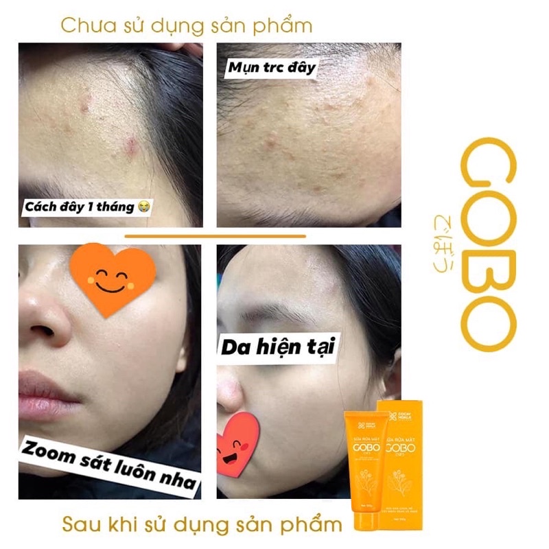 SỮA RỬA MẶT LÀM SẠCH SÂU NGĂN NGỪA MỤN GOBO COCAYHOALA 100g | BigBuy360 - bigbuy360.vn