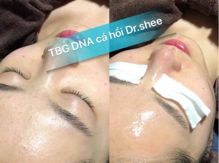 Tế bài gốc DR.SHEE