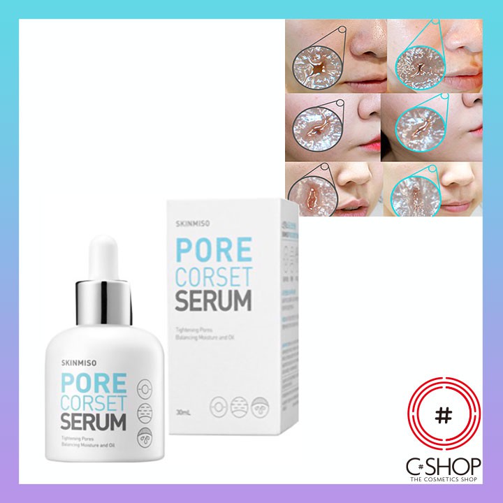 Tinh Chất Hỗ Trợ Se Khít Lỗ Chân Lông SKINMISO PORE CORSET SERUM_Mỹ phẩm Hàn Quốc chính hãng