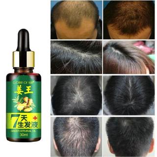 [Hàng mới về] Tinh dầu chăm sóc và kích thích mọc tóc 30ml