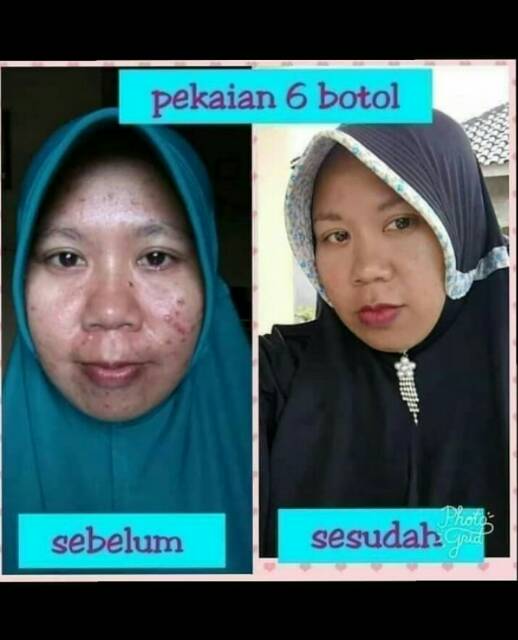 Xịt làm đẹp Natura 100% NaturaWorld chất lượng cao | BigBuy360 - bigbuy360.vn