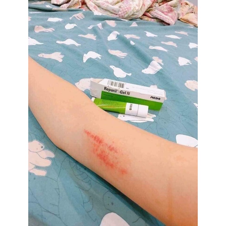 GEL LÀM TAN VẾT BẦM, GIẢM BONG GÂN MEDA REPAIRL GEL N 10G THÁI LAN CHÍNH HÃNG - 9018