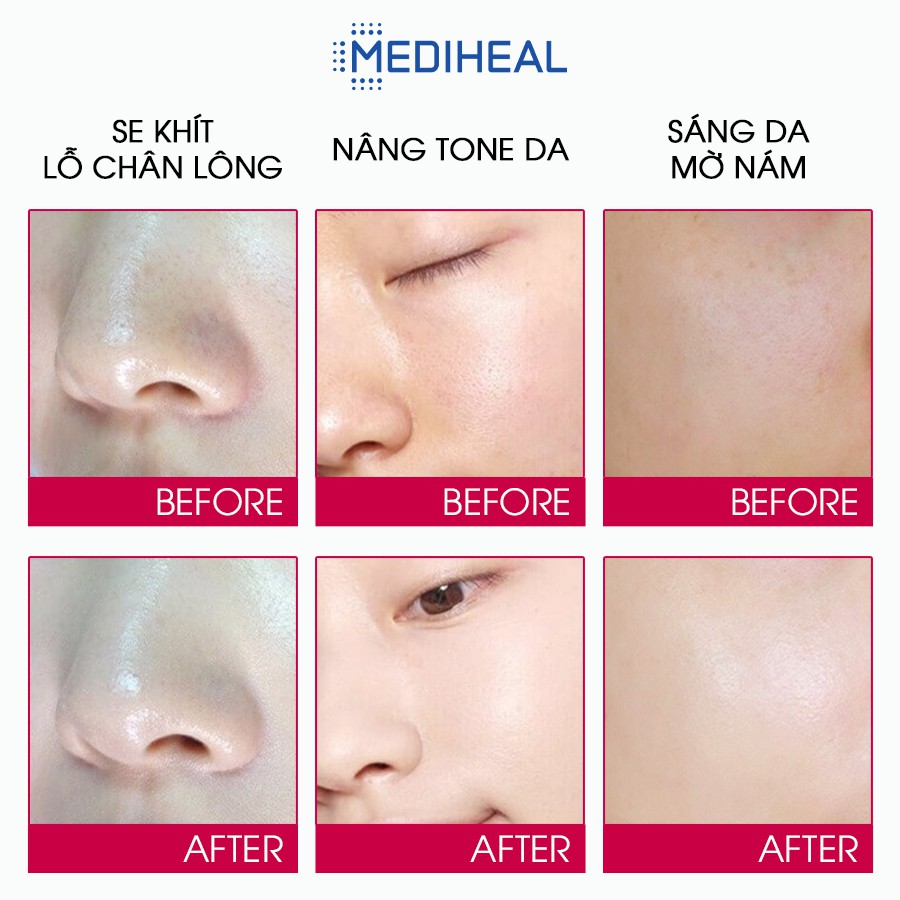 Kem dưỡng trắng da nâng tone MEDIHEAL BRIGHT MELAKILL CREAM 35ml