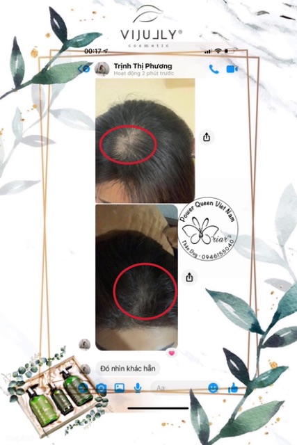 TINH DẦU BƯỞI VI JULLY [Tặng Phụ Kiện Tóc Xinh] - KÍCH THÍCH MỌC TÓC - TRỊ HÓI | BigBuy360 - bigbuy360.vn