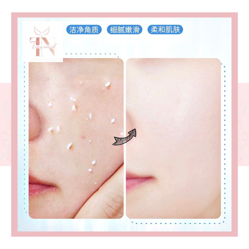 Tẩy Tế Bào Chết Mặt Và Toàn Thân Hoa Cúc Chính Hãng Laikou - Tẩy Da Chết Cấp Ẩm Kiềm Dầu | BigBuy360 - bigbuy360.vn