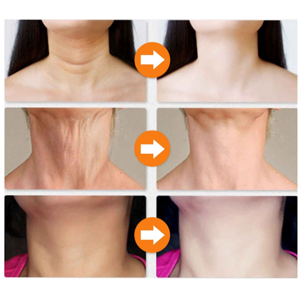 Kem dưỡng da cổ làm trắng dưỡng ẩm săn chắc da chống nếp nhăn
 | BigBuy360 - bigbuy360.vn