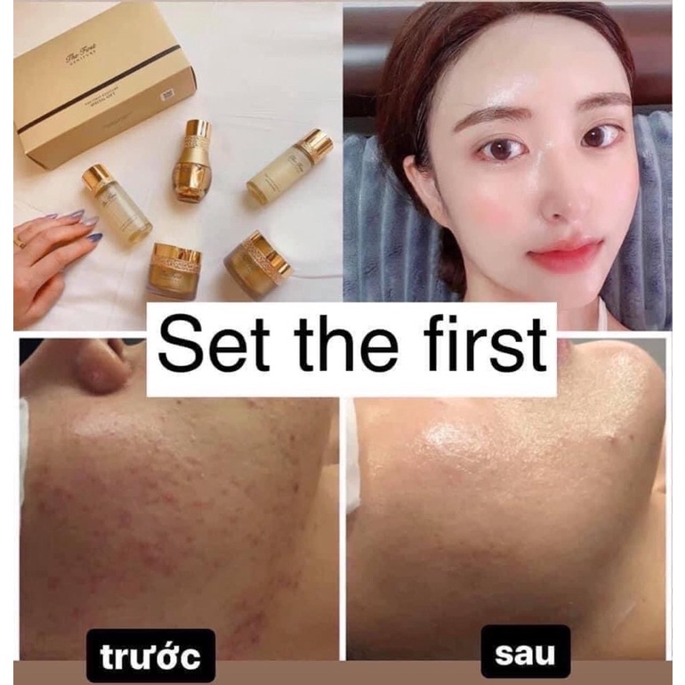 Set dưỡng da 0:HUUI THE FIRST MINI 5Món