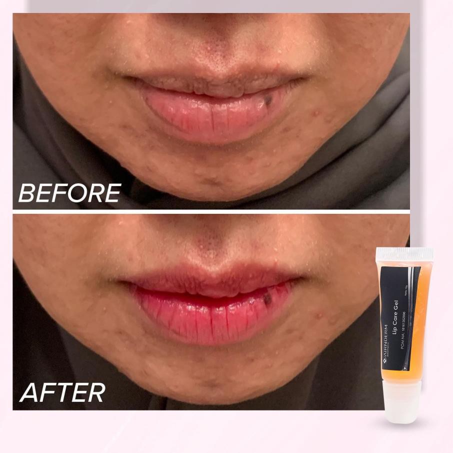 (Hàng Mới Về) Son Dưỡng Môi Dạng Gel Airnderm | BigBuy360 - bigbuy360.vn
