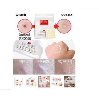 Miếng dán mụn Cosrx Acne Pimple Master Patch