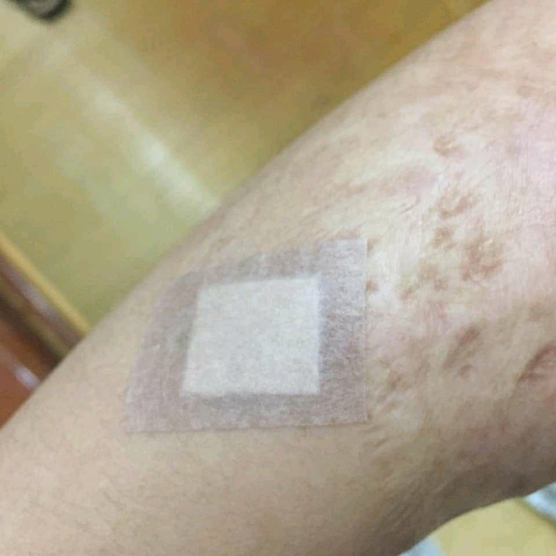 Tấm Dán Xoá Sẹo Làm Mất Sẹo/Sẹo Lồi/Sẹo Thâm/Sẹo Mụn Hisamitsu Của Nhật