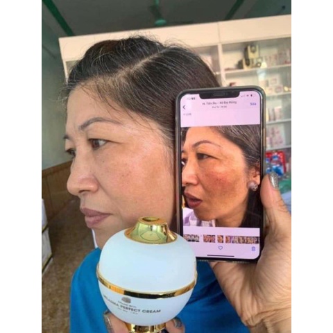 COMBO nám bộ nhỏ 4 sản phẩm chính hãng - Magic skin