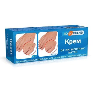 Kem ngăn đồi mồi đốm nâu da tay Kpem Nga – 50ml