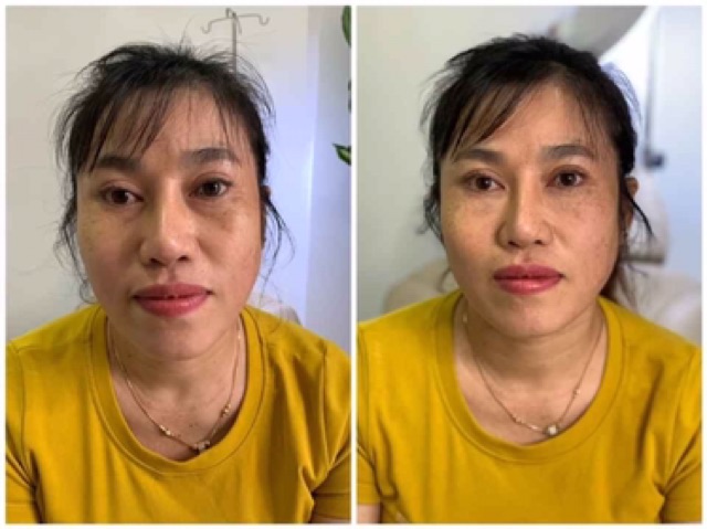 Serum LUMI EYES Hàn Quốc giảm thâm quầng mắt | BigBuy360 - bigbuy360.vn