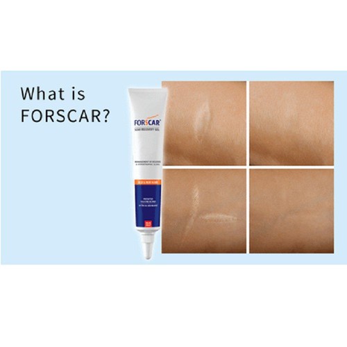 Forscar - silicone gel chăm sóc sẹo được tin dùng tại châu Âu &amp; Mỹ chính hãng nhập khẩu