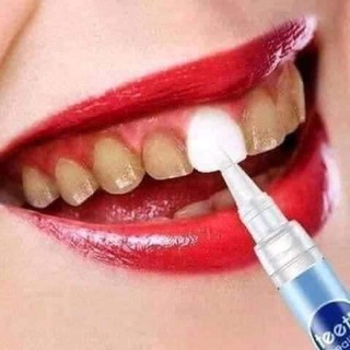 Bút tẩy trắng răng Dazzling White
