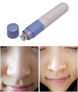 Máy Hút Mụn Cầm Tay Mini