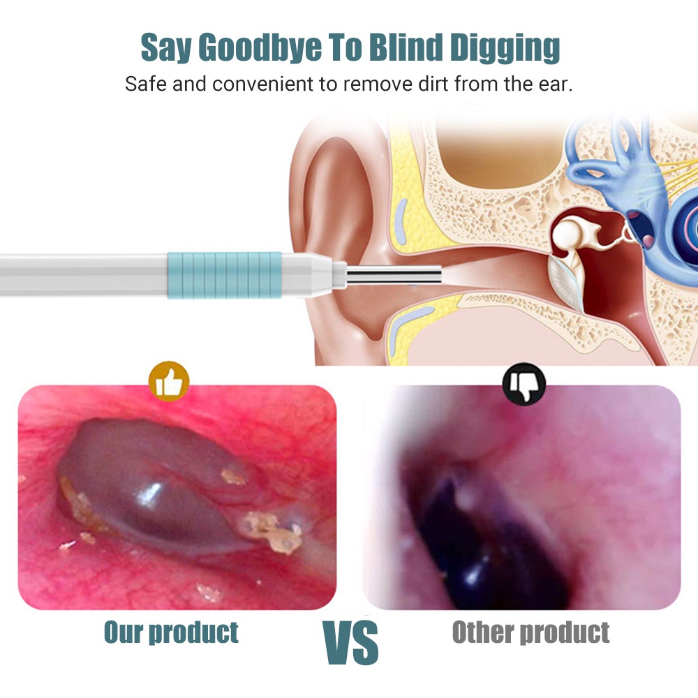 Bộ Dụng Cụ Camera Nội Soi Vệ Sinh Tai Chăm Sóc Sức Khỏe Tiện Dụng