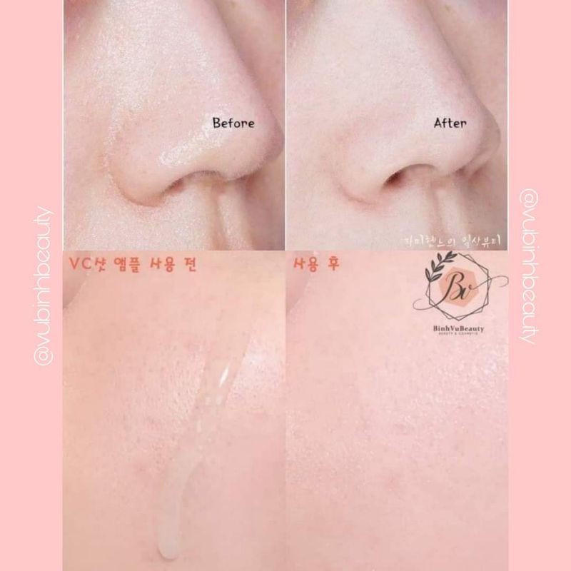 Serum Tinh Chất giảm thâm giảm tàn nhang dưỡng da Vitamin C AMPLEN VC Shot Ampoule Serum