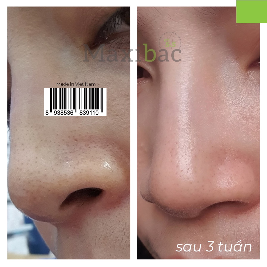Sữa rửa mặt, srm đầu cọ tạo bọt lành tính, giảm mụn, trắng da, tẩy tế bào chết cho da dầu, da khô - MAXIBAC chính hãng