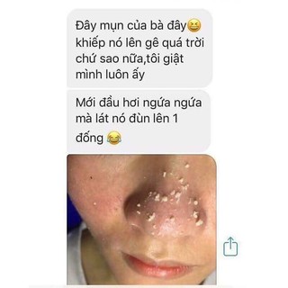 MIẾNG DÁN ĐẨY MỤN ĐẦU ĐEN ciracle goodbye blackhead Hàn Quốc