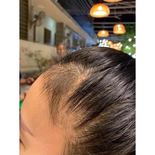 Dầu Gội Bưởi Rừng THH 🍐[ Chính Hãng ]