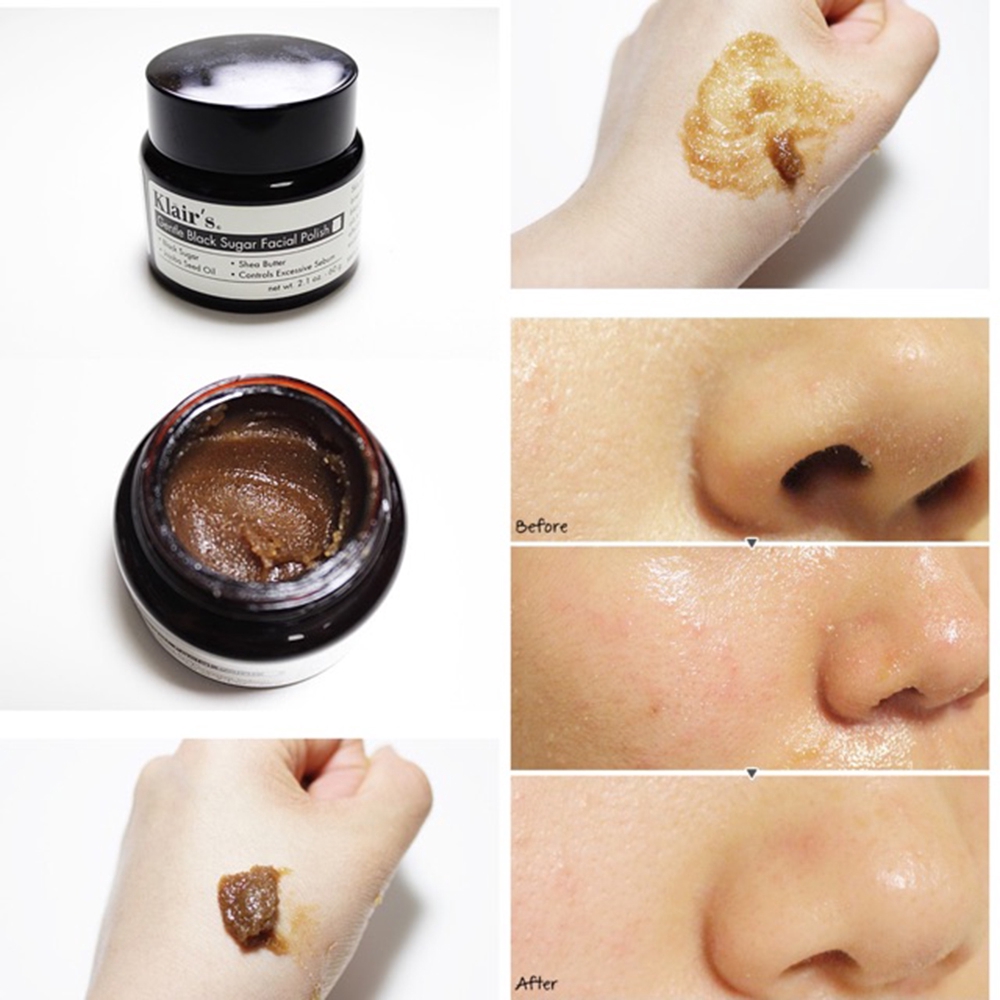 Tẩy Tế Bào Chết giảm Mụn Đầu Đen, Giúp Da Mềm Mịn Với Đường Đen Klairs Gentle Black Sugar Facial Polish - Skin hub