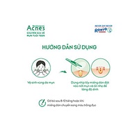 Miếng dán mụn Acnes (12 miếng)