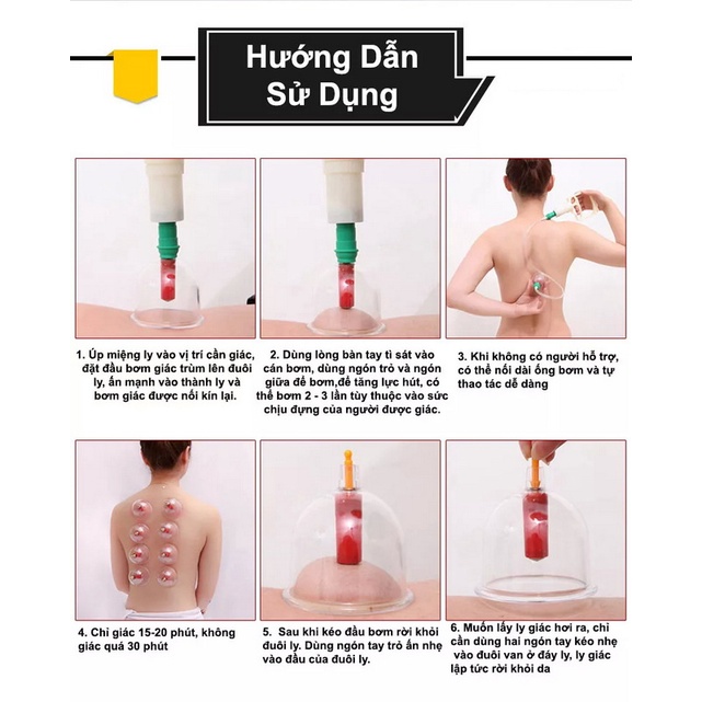 Bộ Giác Hơi KAW 24 Ống Không Dùng Lửa Hút Chân Không - Giải Độc Cơ Thể Hiệu Quả, An Toàn