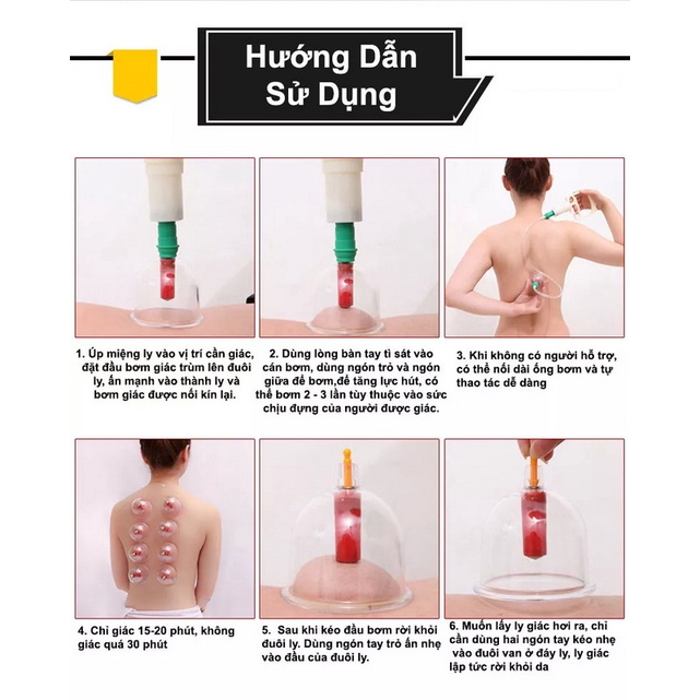 Bộ Giác Hơi 24 Ống Hút Chân Không Hàn Quốc, không dùng lửa, Hiệu quả-An toàn-BH 1 đổi 1