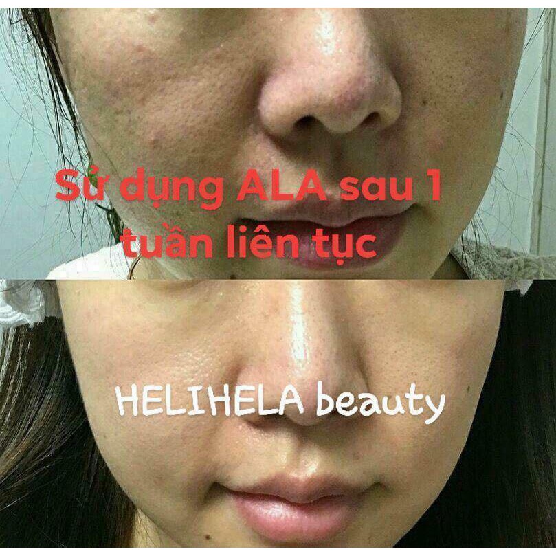 Tách Lẻ 1 ống Tế bào gốc Ala nâu 10ml | BigBuy360 - bigbuy360.vn