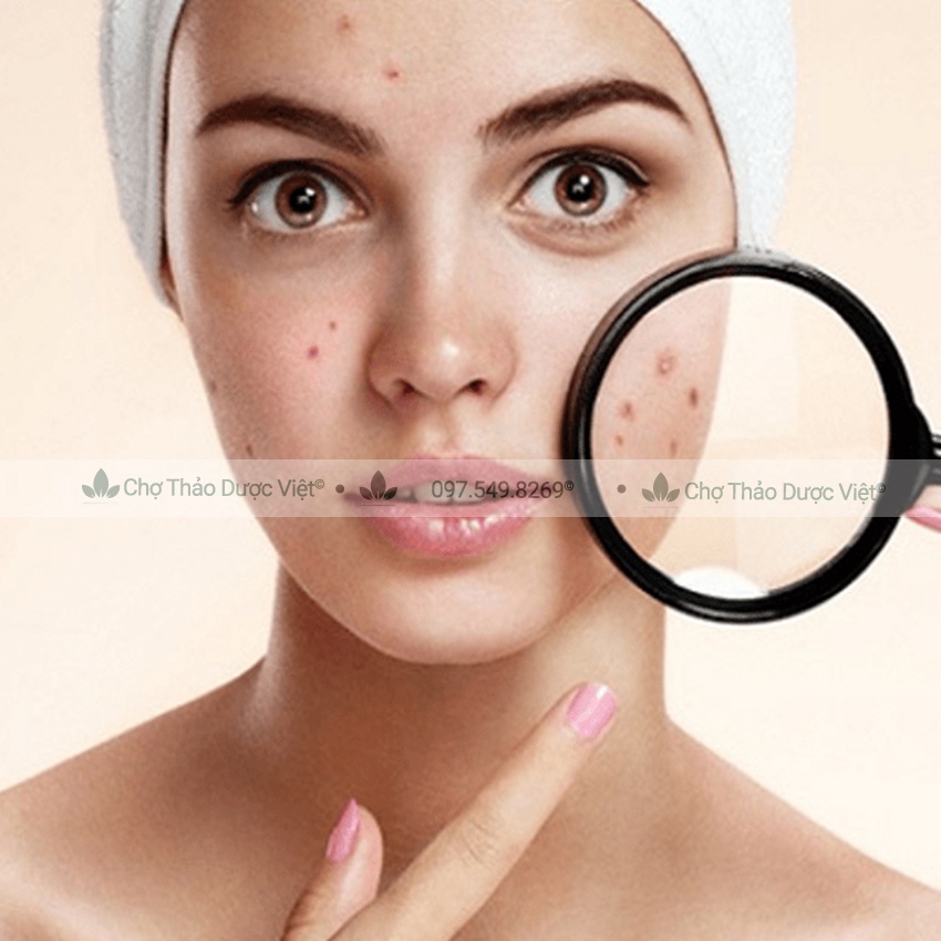 Set 10 loại bột cho da mun (Bột hữu cơ, kháng khuẩn, ngăn ngừa mun ẩn, dưỡng da) - Chợ Thảo Dược Việt