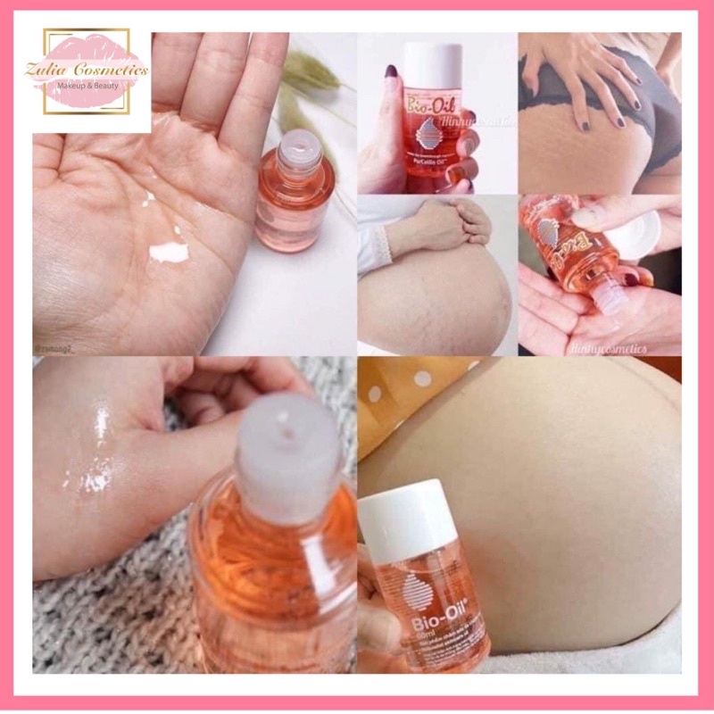 [FREE SHIP] Tinh Dầu Bio Oil Ngừa Rạn Mờ Sẹo