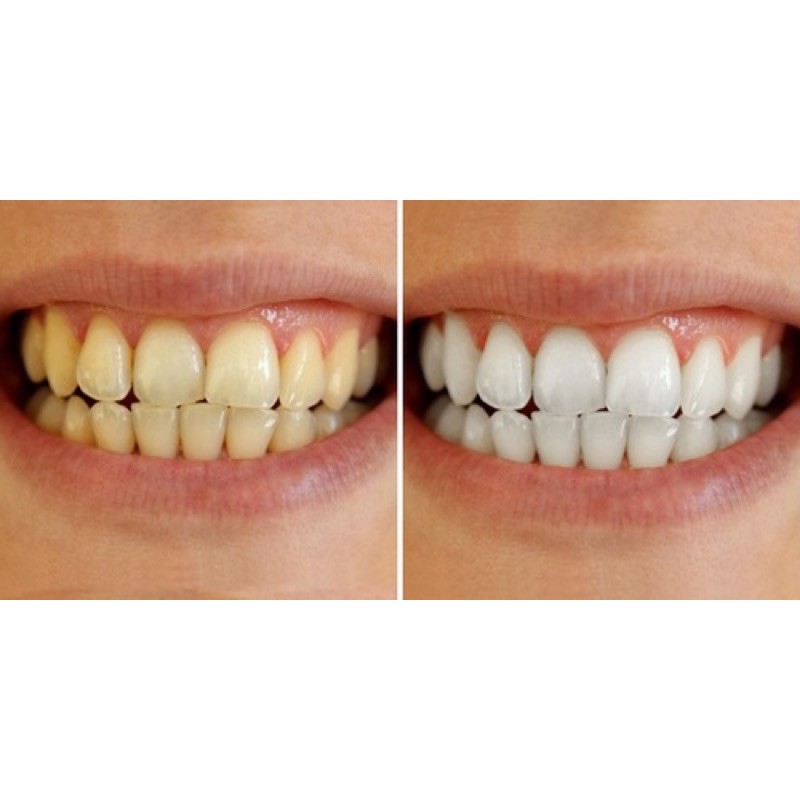 BỘT TRẮNG RĂNG -HẾT HÔI MIỆNG- SẠCH MẢNG BÁM