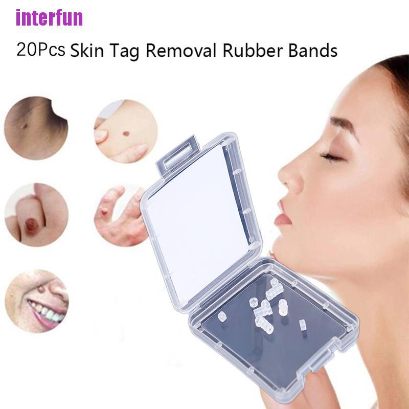 [Hàng mới về] Set 20 vòng cao su loại bỏ thịt thừa không độc hại