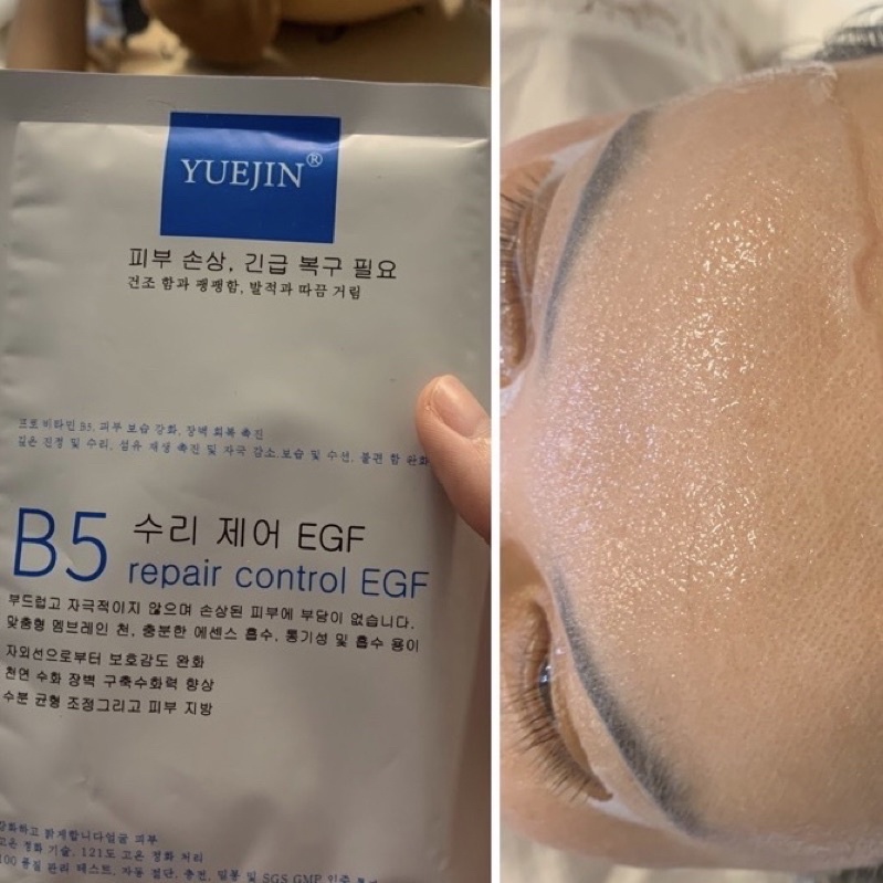 Mặt Nạ YUEJIN B5 Hàn Quốc 𝗬𝗨𝗘𝗝𝗜𝗡 𝗕𝟱 Phục Hồi Da Tổn Thương, Da Treatment Nhạy Cảm