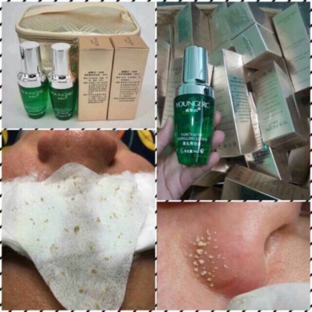 Tinh Chất Ủ Mụn Mới 2020 30ml - Đồ tiêu hao spa, thẩm mỹ viện