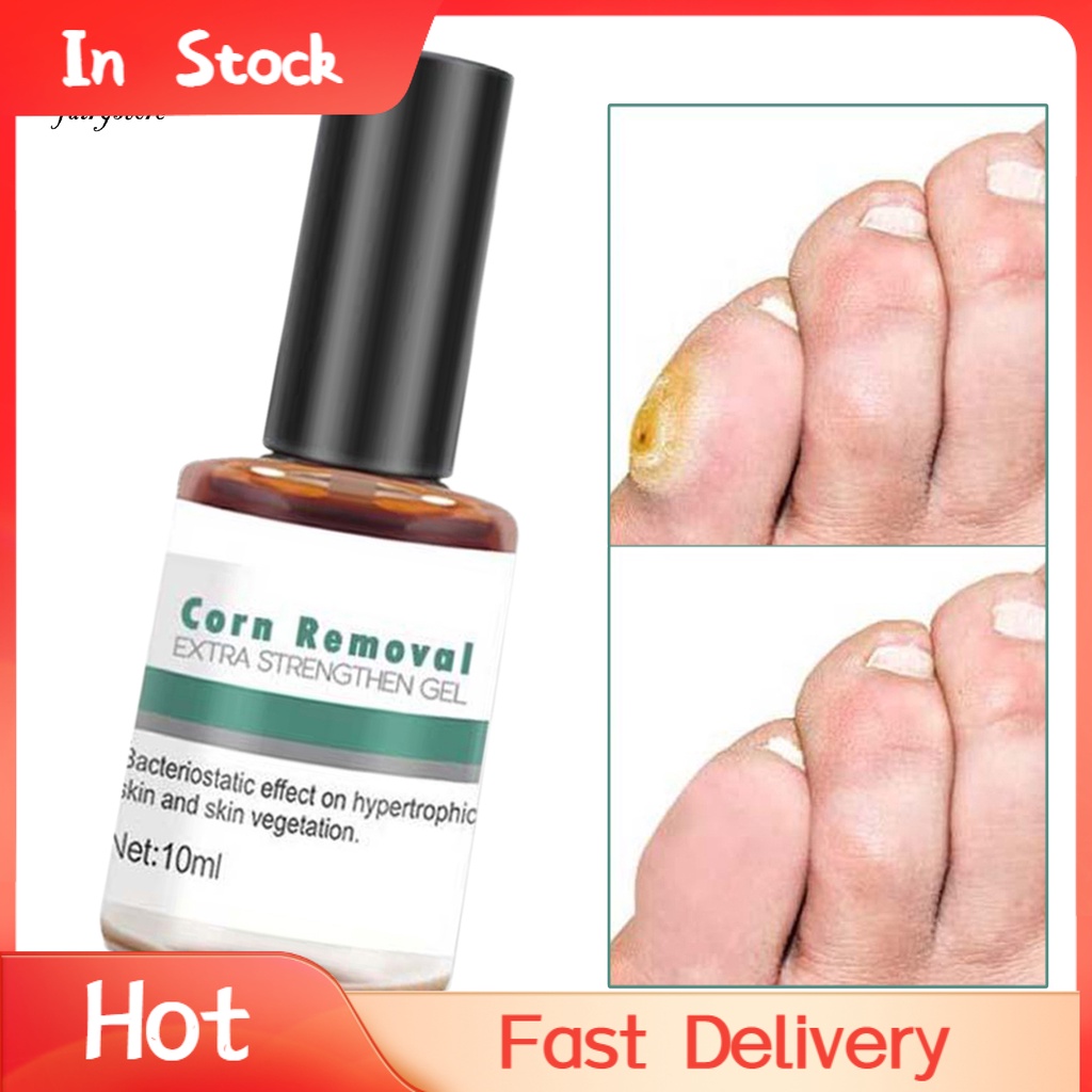 Kdfs- Tinh Chất Loại Bỏ Các Vết Đốm Và Loại Bỏ Lõm Mini Sử Dụng Ngoài Sử Dụng Ngoài