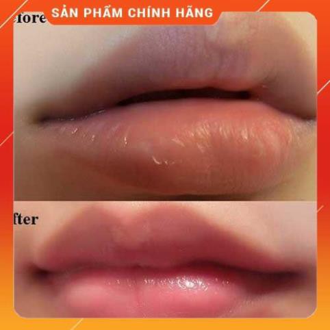 Tẩy Da Chết Môi Beauty Treats Lip Scrub Mỹ | BigBuy360 - bigbuy360.vn