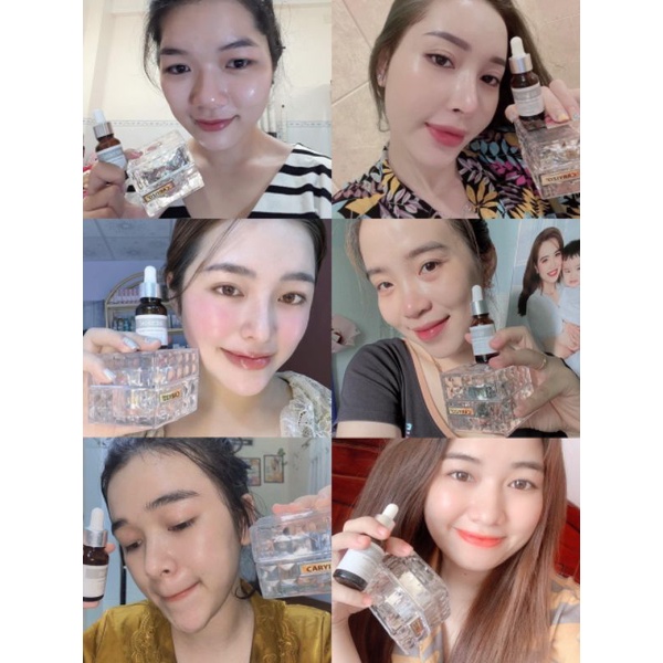 Combo face Beskin dưỡng trắng chuyên sâu Tế bào gốc và kem face 4 in 1
