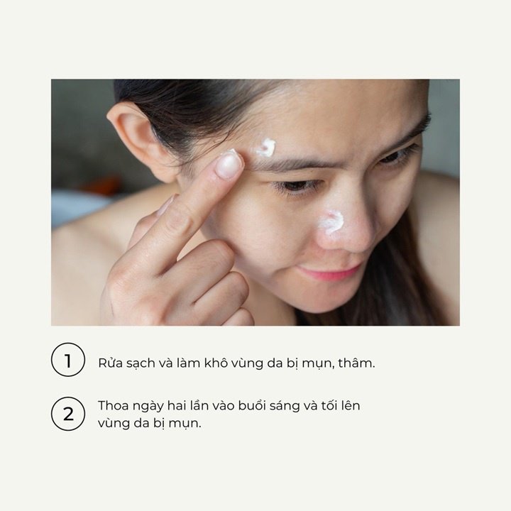 Megaduo Gel Gamma Azelaic Acid &amp; Glycolic Acid (AHA) Giảm Mụn Ẩn, Thâm, Đầu Đen Cho Da Dầu Mụn 15g