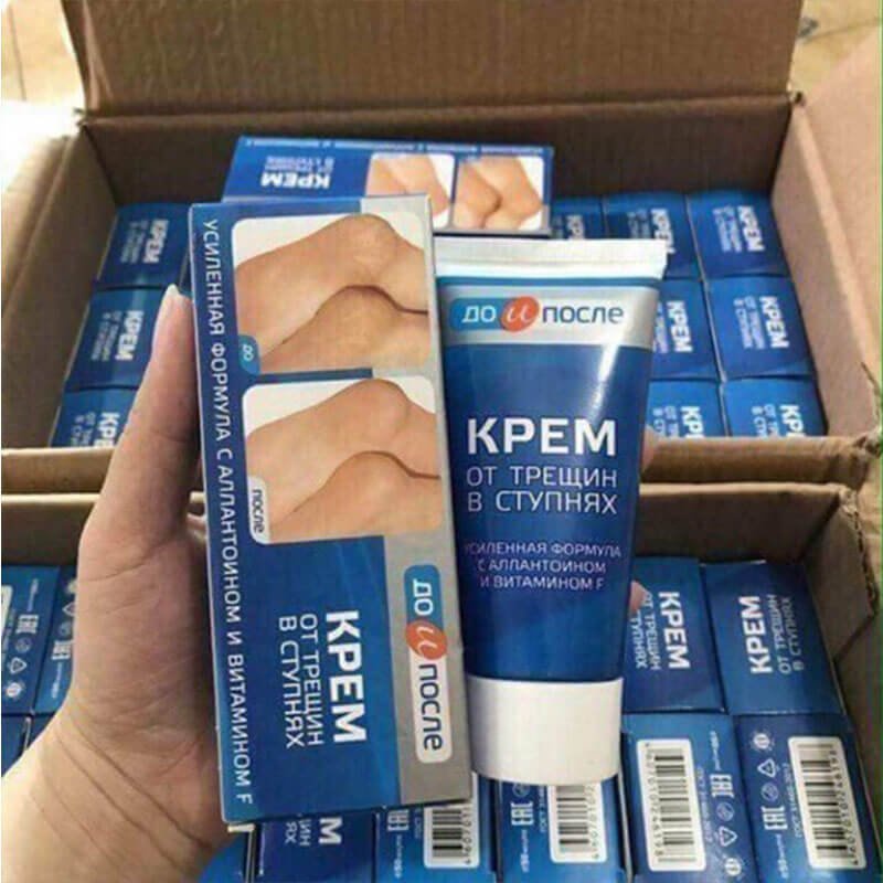 Kem Giảm Nứt Gót Chân Kpem Apteka Của Nga 50ml